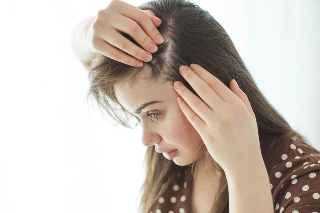 a má circulação causa sintomas como queda de cabelo por não irrigar o couro cabeludo corretamente