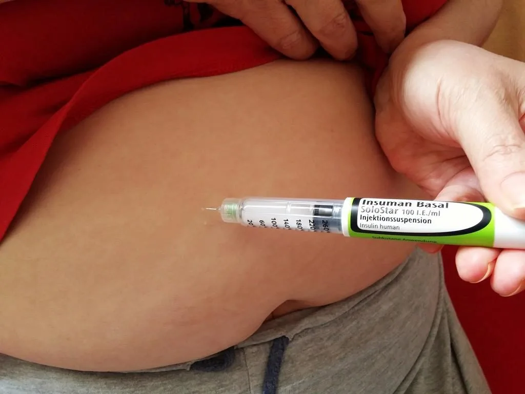 apenas diabéticos tipo 1 usam a insulina como única forma de tratamento