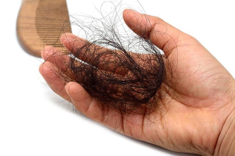 queda de cabelo no pós-parto