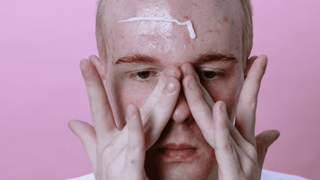 vitacid acne