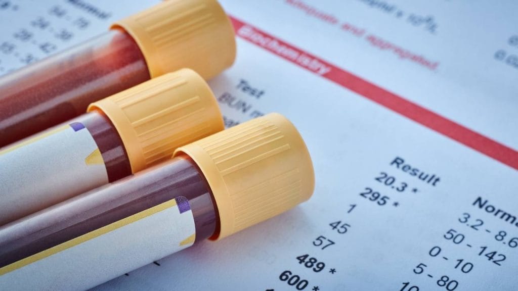 Exame de sangue pode confirmar se a vitamina D está baixa no organismo.