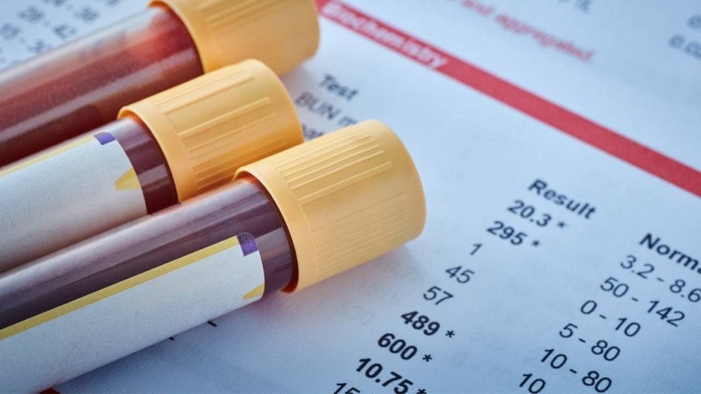 Três tubos contendo amostras de de sangue sobre um resultado de hemograma.