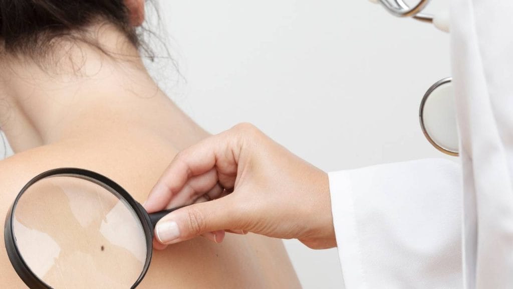 Médico analisando pinta nas costas da paciente para identificar possível caso de câncer de pele.