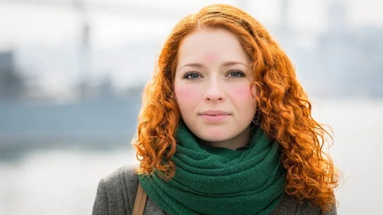 Saiba porque o rosto fica vermelho no frio e como evitar.