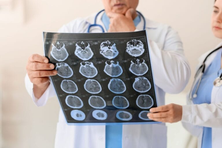 médico analisando exame de pessoa com azheimer