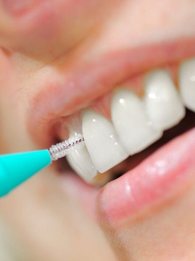 Como usar escova interdental? Dicas práticas e cuidados essenciais