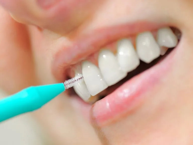 dentes de uma pessoa usando escova interdental
