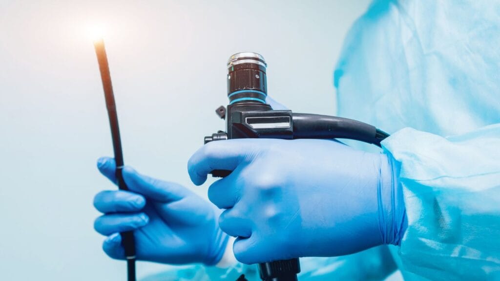 endoscopia