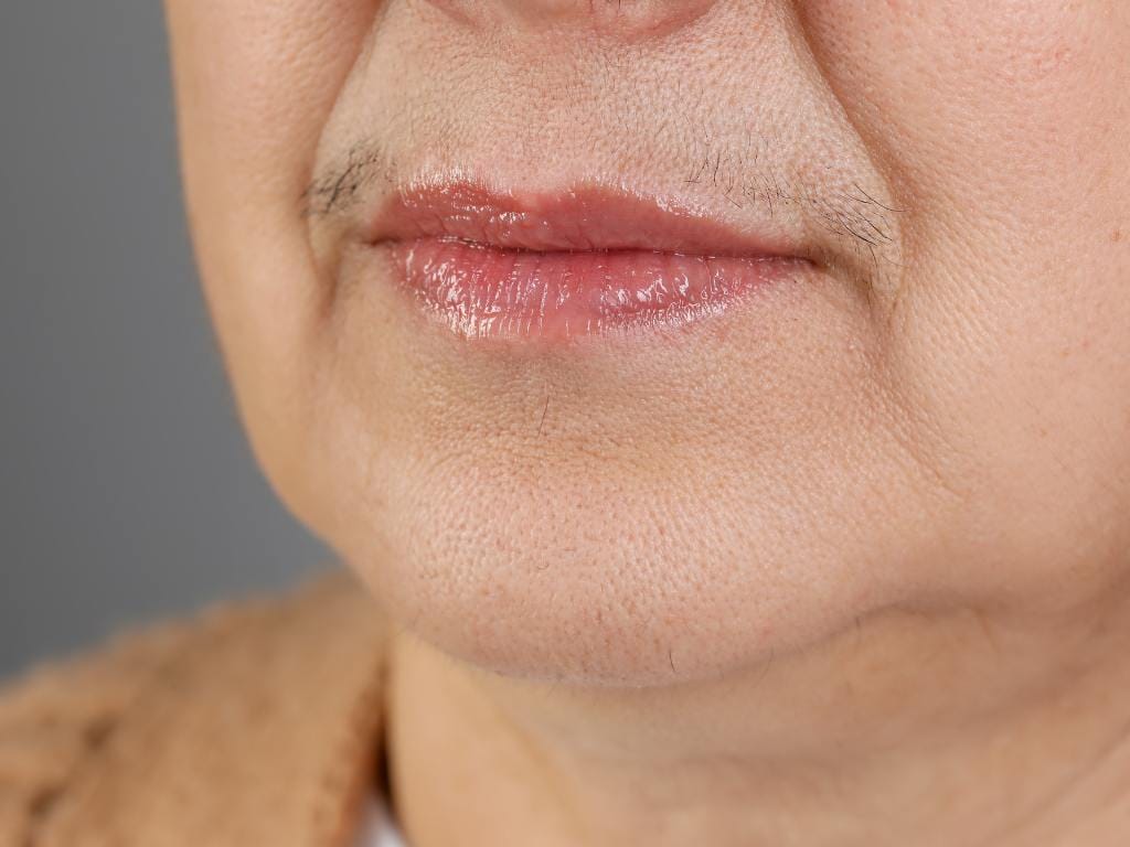 Mulher com pelos faciais