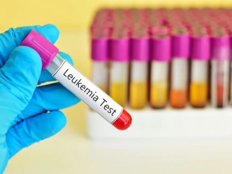 Teste de Leucemia